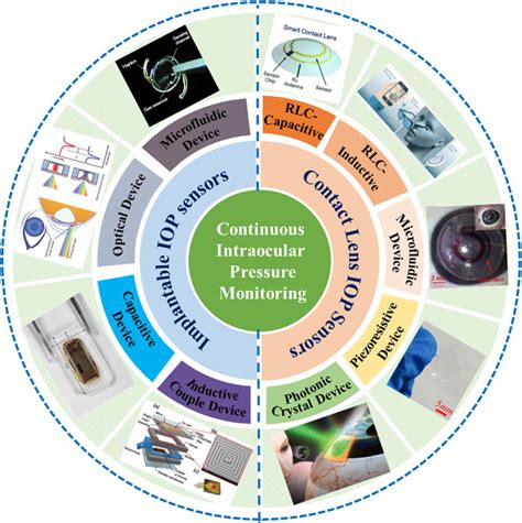 Recent Progress Of Continuous Intraocular Pressure Monitoring Xu