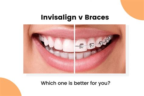 Invisalign Vs Braces Which One Is Better For You In 2024