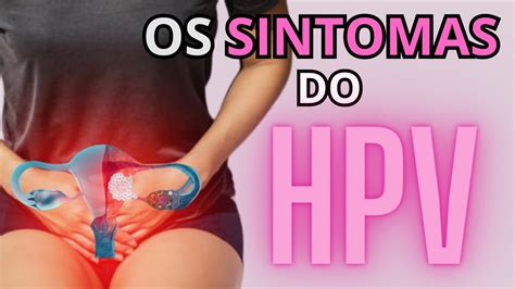 Sintomas Do Hpv Papiloma V Rus Humano Doen A Extremamente