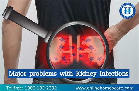 Major problems with Kidney Infections – Online Homeocare
