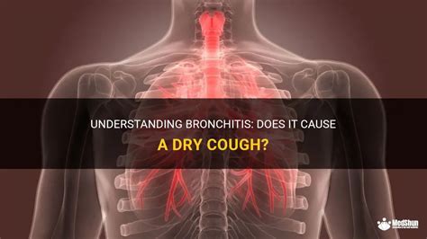 Understanding Bronchitis Does It Cause A Dry Cough Medshun