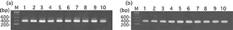 Polymerase Chain Reaction Pcr Amplifi Cation Products Of The Internal