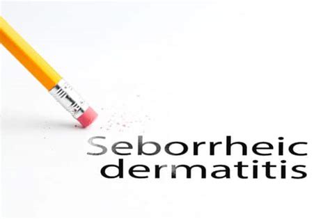 Fda Approves Zoryve Roflumilast Foam 03 For Seborrheic Dermatitis Livderm