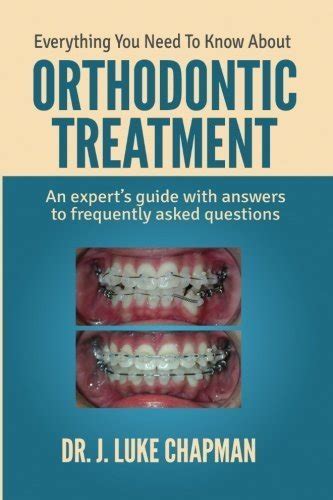 Everything You Need To Know About Orthodontic Treatment An Expert S