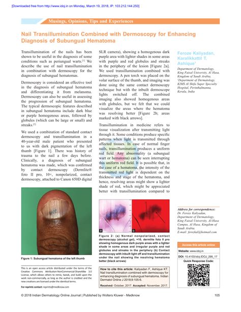 Pdf Nail Transillumination Combined With Dermoscopy For Enhancing