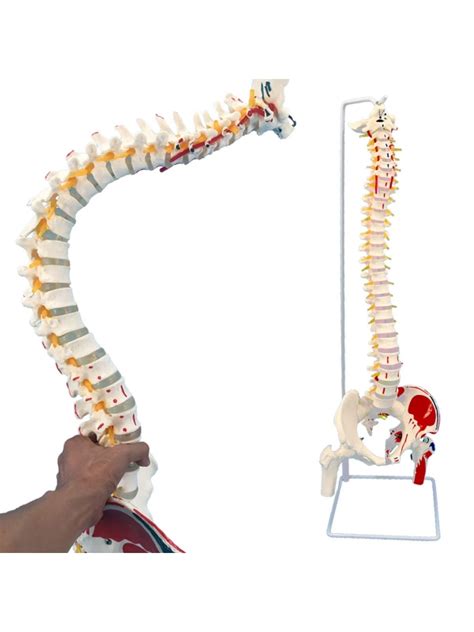 Lumbar Vertebrae With Sacrum Coccyx And Herniated Disc Life Size