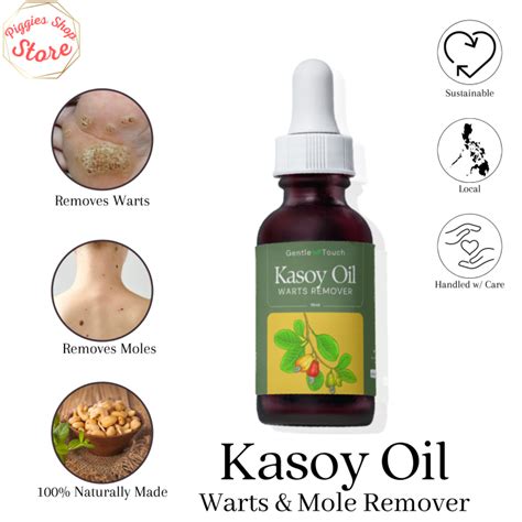 Gentle Touch Original Kasoy Oil Ml Warts Mole Remover Infused