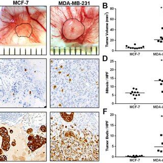 Invasive Growth Rate Of Mcf And Mda Mb Breast Cancer Cells In