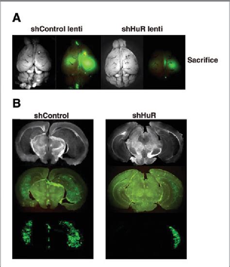 Figure 1 From The RNA Binding Protein HuR Promotes Glioma Growth And