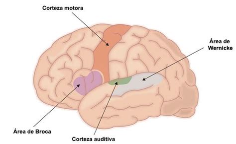 Afasia de Broca características y definición