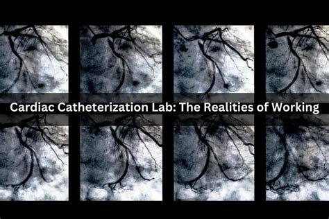 Cardiac Catheterization Lab: The Realities of Working