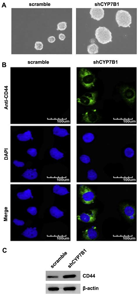 Microrna 17 Induces Epithelial Mesenchymal Transition Consistent With