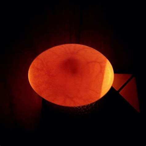 Can You Eat Fertilized Chicken Eggs
