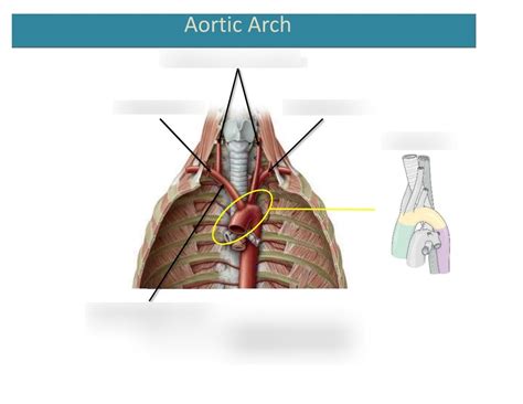 Aortic Arch Diagram Quizlet