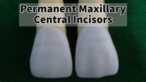 Upper Central Incisors