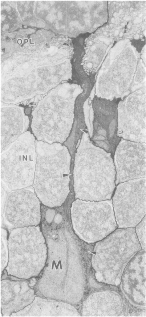 Microscopic Autoradiography Semantic Scholar