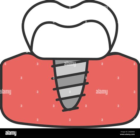 El Icono Color De Implantes Dentales Implante Endo Ilustraci N