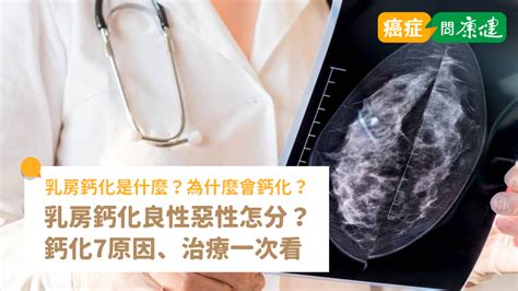 乳房鈣化是什麼？鈣化良性惡性怎麼分？鈣化7原因、治療一次看 癌症問康健