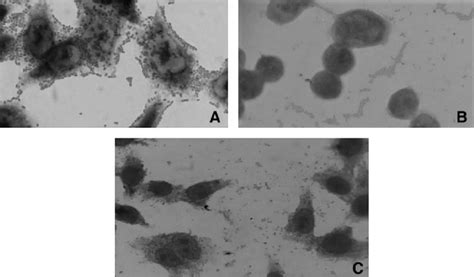 A EAEC 042 Strain Showing Aggregative Adherence On HeLa Cells B