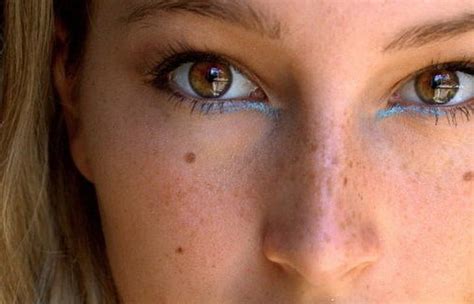 O cualquiera Mala suerte Increíble pecas en los ojos infancia contenido