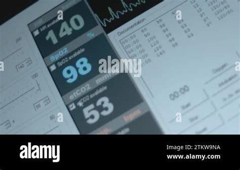 Close Up View Of The Screen Of Patient Monitor Displays Vital Signs ECG