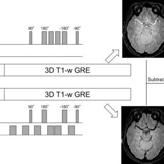 Three Dimensional Phase Contrast Mr Angiography Pc Mra Maximum