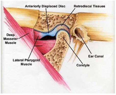 Dentistry And Medicine Standard Of Care Temporomandibular Joint Disorder