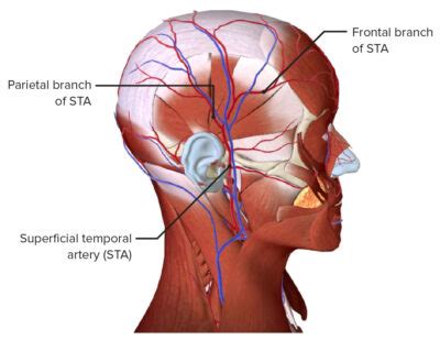 Giant Cell Arteritis Concise Medical Knowledge