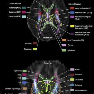 Brain Regions Assessed At Near Term Age With Dti Measures Of Fractional