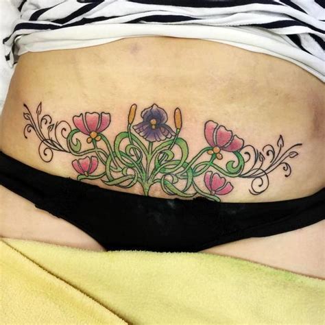 Tummy Tuck Tattoo Cover Up Senturinomega