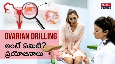 Does Ovarian Drilling Work For Pcos L Dr Swathi Hv Medplusonetv