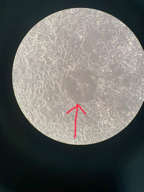 115 Questions With Answers In 3t3 L1 Cells Scientific Method