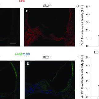 DHE And 4 HNE Staining In Cochlear Organotypic Cultures From P5 Gjb2