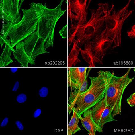 Alexa Fluor® 488 Anti Alpha Smooth Muscle Actin Antibody Epr5368