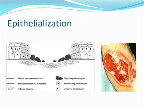 PPT - Wound Care PowerPoint Presentation, free download - ID:5403940