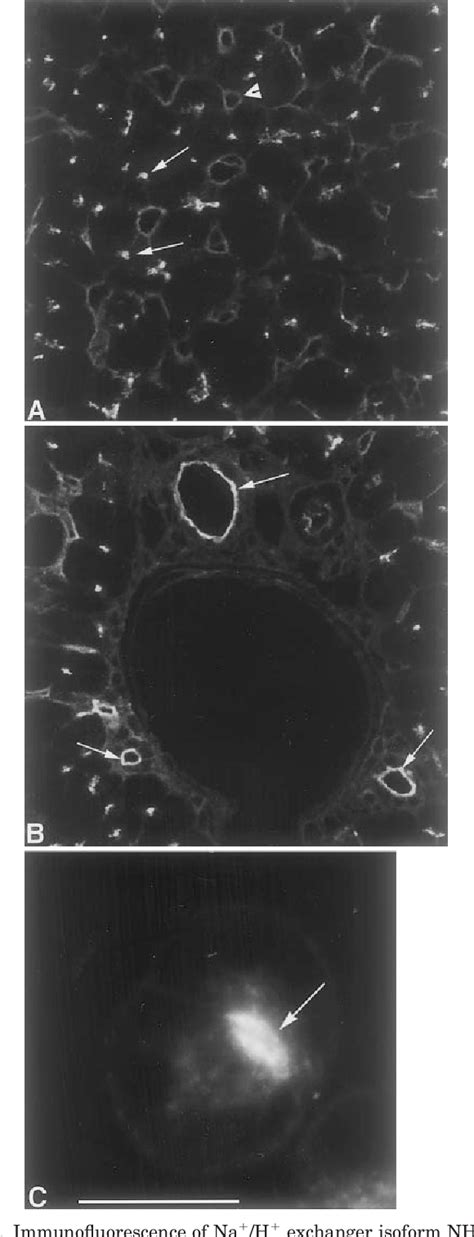 Figure 1 From Role Of Sodium Hydrogen Exchanger Isoform NHE3 In Fluid