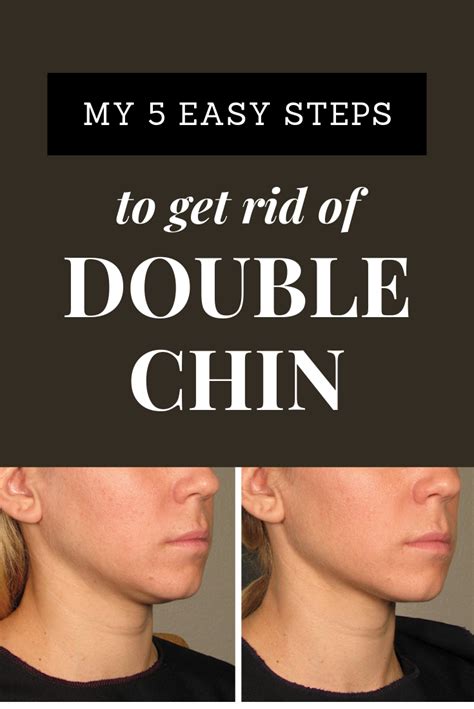 My 5 Easy Steps To Get Rid Of Double Chin Double Chin Chin Loose