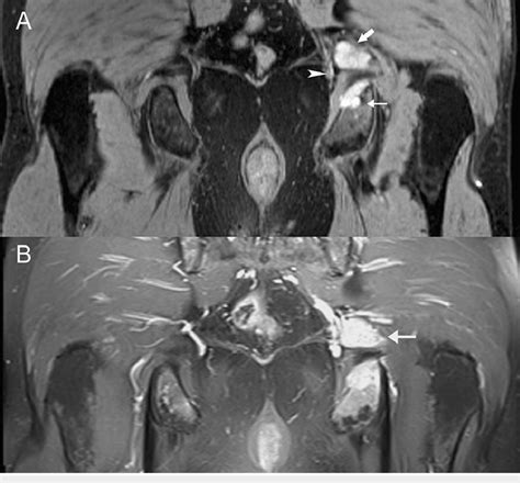 A 58 Year Old Man With Advanced Metastatic Disease Due To The Spread Of Download Scientific