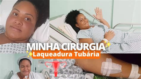 Minha Cirurgia Laqueadura Tub Ria Pr Operat Rio P S Operat Rio