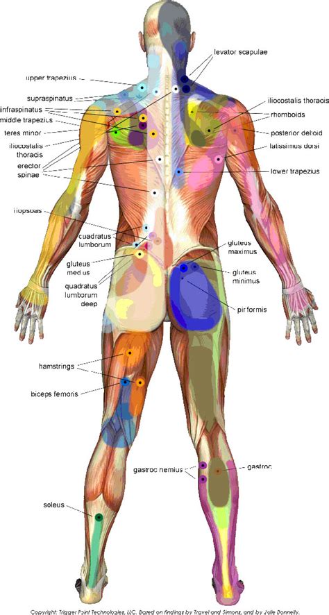 Travell and simons trigger point for sciatica - locedgraph