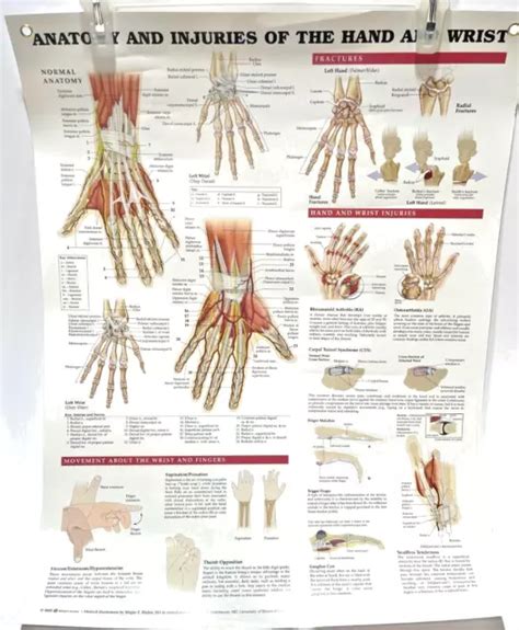 Anatomy And Injury Of Hand And Wrist Anatomical Chart Laminated