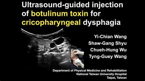 Ultrasonography Guided Botulinum Toxin Injection To The 52 Off