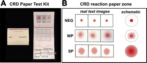 Congo Red Dot Paper Test For Antenatal Triage And Rapid Identification