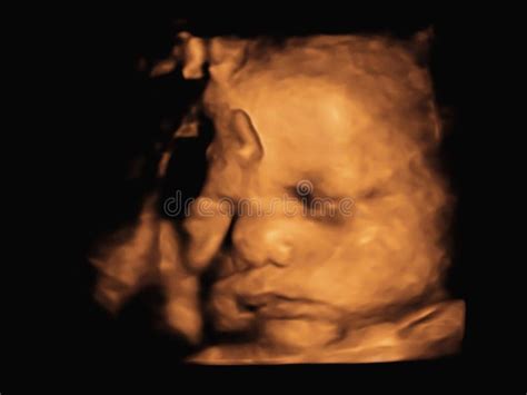 Image Ultrasound D D Of Baby In Mother Womb Stock Image Image Of