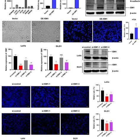 Ism Promotes Emt And Crc Progression In Vitro A Quantitative