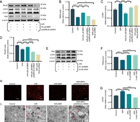 Figure 2 From Berberine Inhibits Excessive Autophagy And Protects