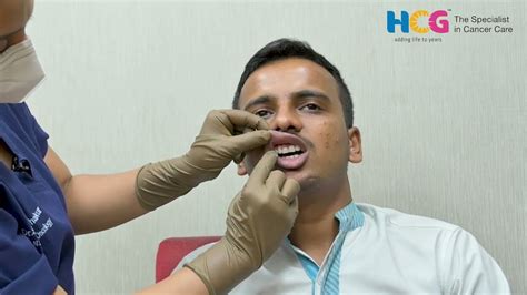 Oral Cancer Screening Easy Steps मुँह का कैंसर कैसे होता है Mouth