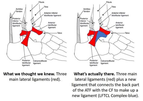 Torn Ankle Ligament Surgery The Hammer And The Nail Effect