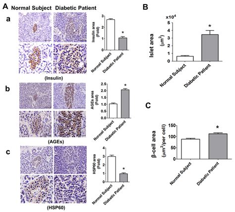 Immunohistochemical Staining For Insulin Ages And Hsp60 In The