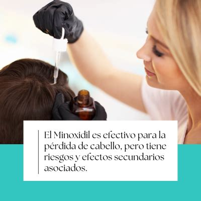 Los Efectos Secundarios Del Minoxidil